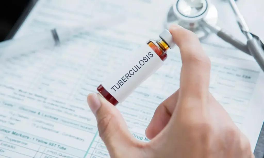 WHO Global Tuberculosis Report 2025